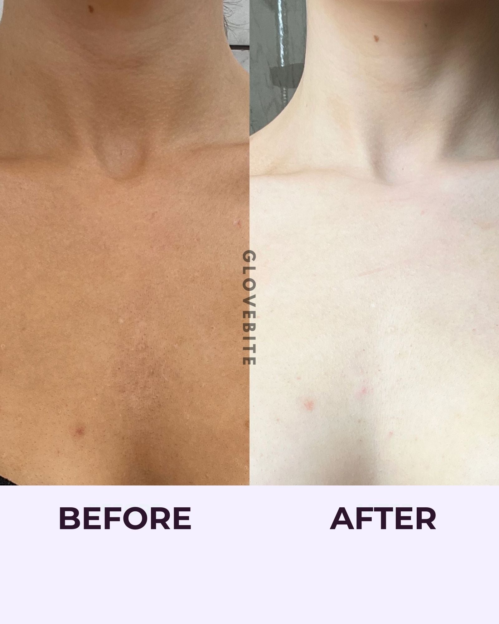 Before and Afer Glovebite fake tan removal, Patchy tan removal, Self tanner removal